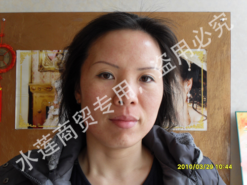 真皮斑治療前